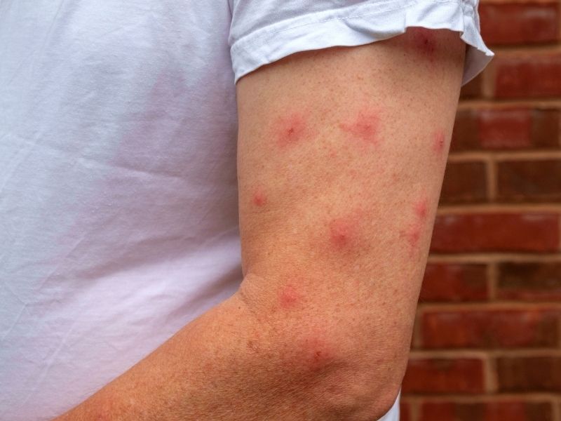 ¿Qué es el virus del nilo? - Abecor